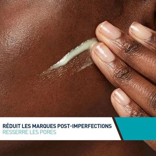 Sérum Rétinol Anti-Marques - Peaux à Imperfections 30ml - CeraVe – Image 5