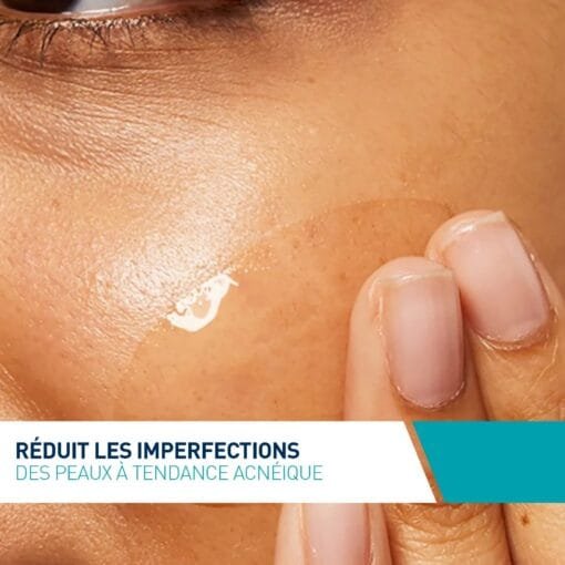 Soin Concentré Anti-Imperfections - Peaux à Imperfections et Tendance Acnéique 40ml - CeraVe – Image 6